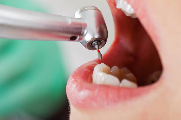 Best Emergency Treatment for Oral Infections in Ralston, NE